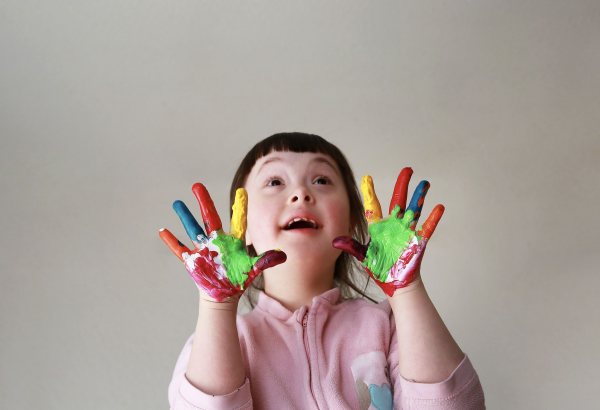 Down Syndrome Pada Anak